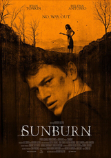 sunburn